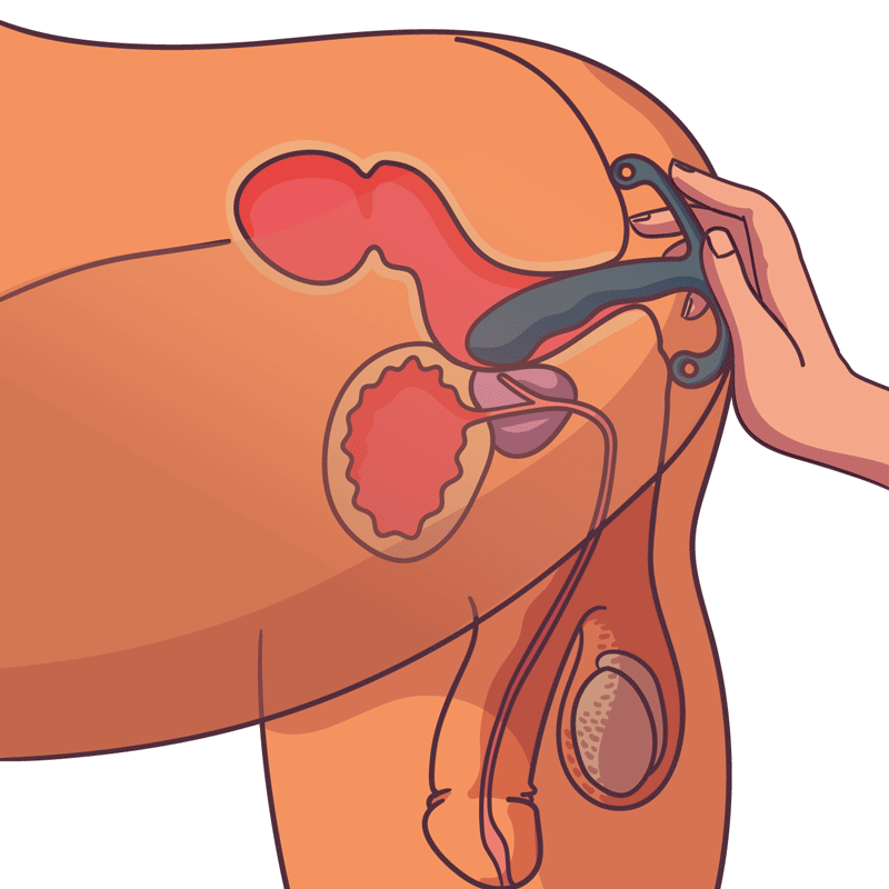 Productfoto bij keuzehulp over prostaat massager gids bij De Paarse Keizerin met eerlijk advies en productoverzicht